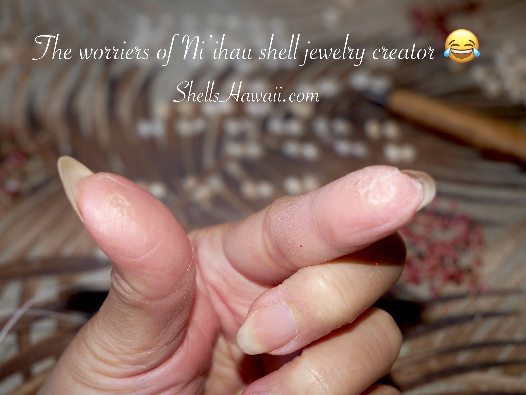 Close-up of Janjira&rsquo;s fingers showing bruising, dryness, and cracked skin from poking Niʻihau shells, capturing the real hands-on labor behind Niʻihau shell jewelry making at ShellsHawaii.com.