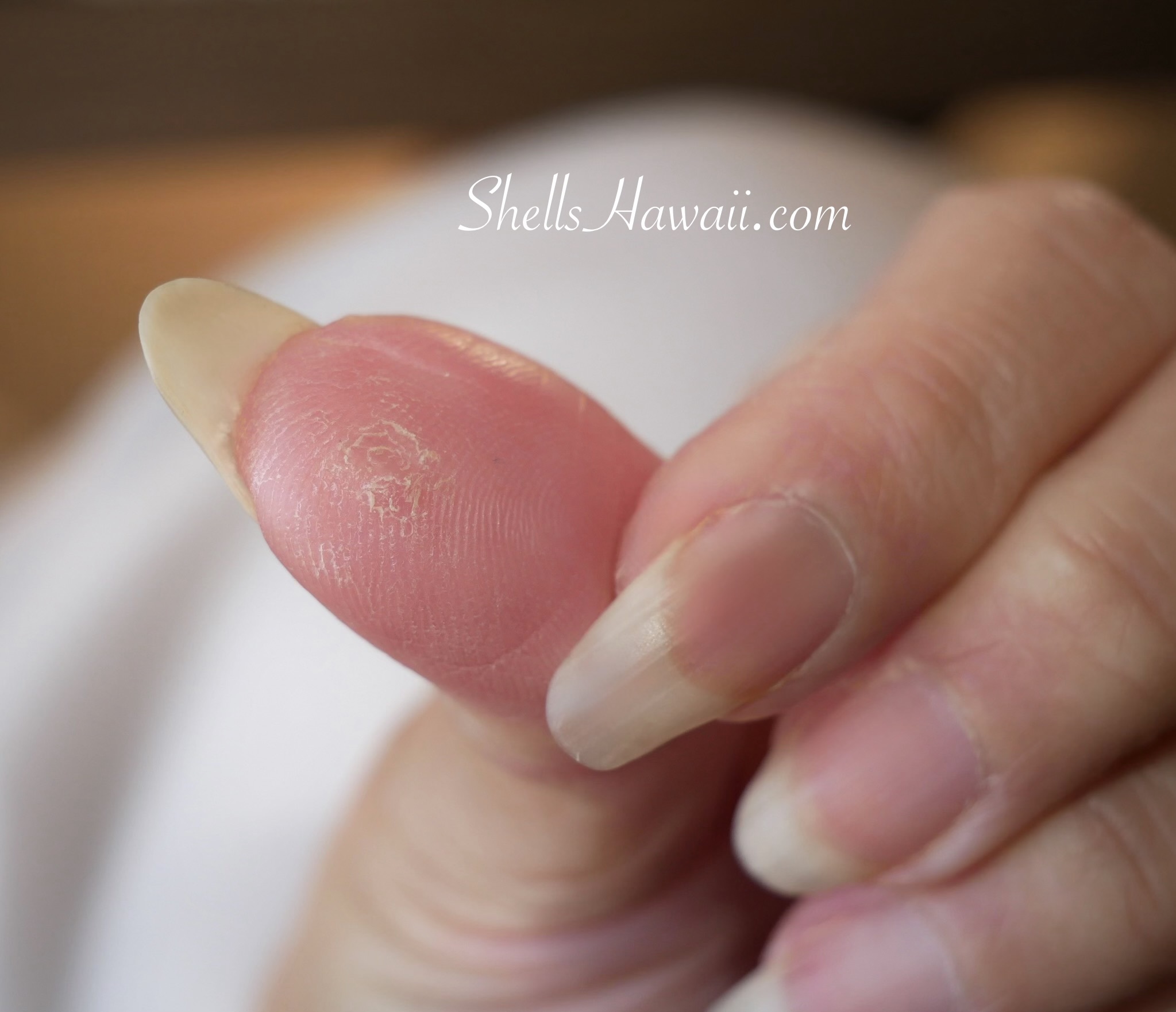 Close-up of Janjira&rsquo;s finger showing cracked, bruised skin from poking Niʻihau shells, revealing the physical labor and craftsmanship behind handmade Hawaiian shell jewelry at ShellsHawaii.com.